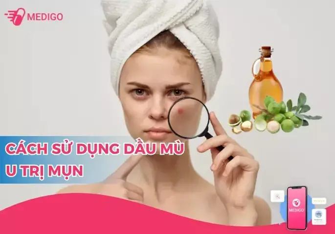 Dùng Dầu Mù U Trị Mụn