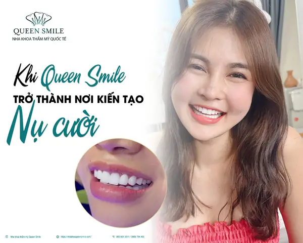 Dung Dịch Vệ Sinh Queen Smile