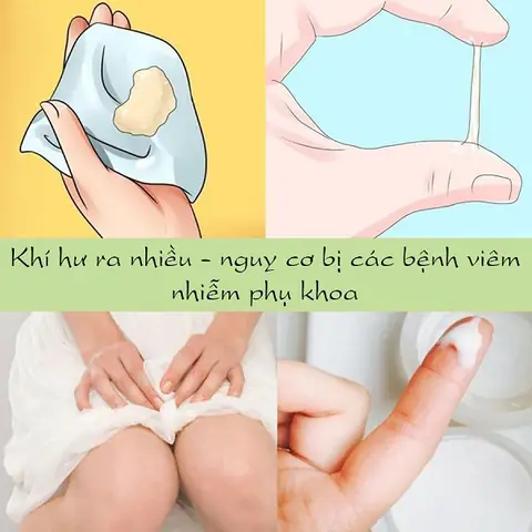 Dùng Dung Dịch Vệ Sinh Phụ Nữ Như Thế Nào