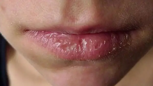 Dưỡng Ẩm Cho Môi Tại Nhà