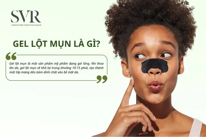 Gel Lột Mụn Bị Đông Phải Làm Sao