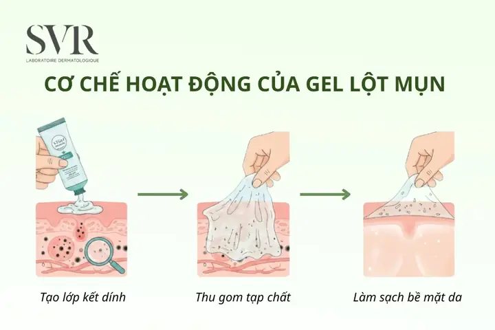 Gel Lột Mụn Bị Đông Phải Làm Sao