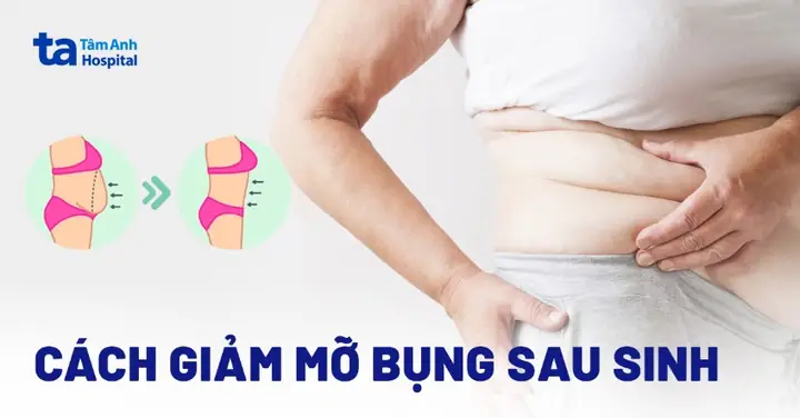 Giảm Vòng 2 Sau Sinh Mổ