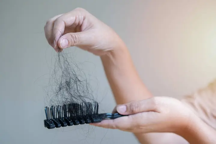 Gội Đầu Xong Tóc Rụng Nhiều