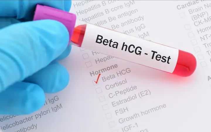 Hcg Dương Tính Nhưng Không Có Thai
