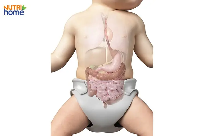 Hiện Tượng Giãn Ruột Trẻ Sơ Sinh