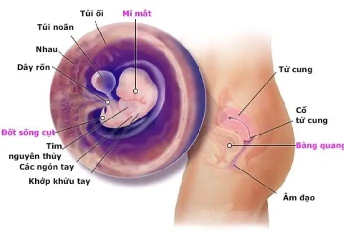Hình Ảnh Túi Ối Trong Tử Cung