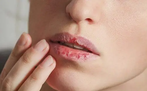 Hướng Dẫn Làm Tẩy Tế Bào Chết Cho Môi