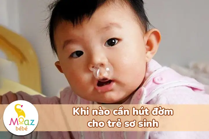 Hút Đờm Cho Trẻ Sơ Sinh 1 Tháng Tuổi