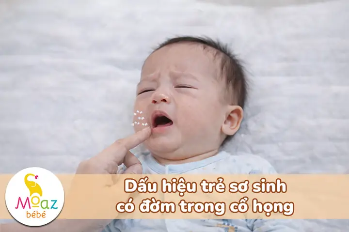 Hút Đờm Cho Trẻ Sơ Sinh 1 Tháng Tuổi