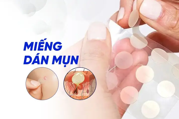 Hút Mụn Có Tác Dụng Gì