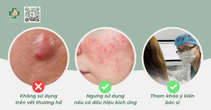 Hút Mụn Có Tác Dụng Gì