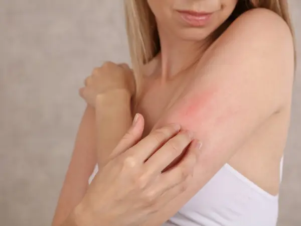 Kem Body Cho Da Nhạy Cảm