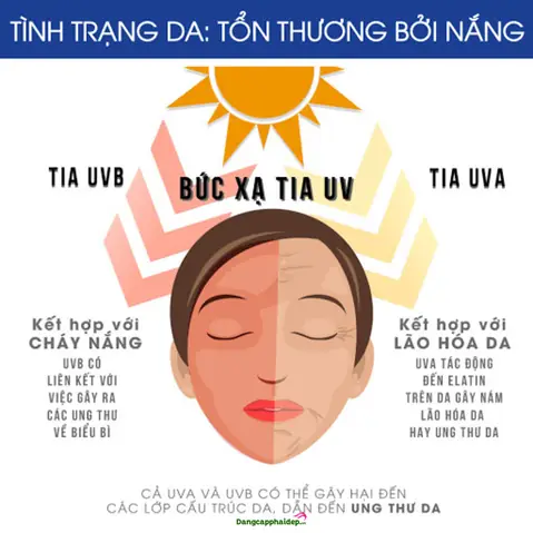Kem Chống Nắng Có Quan Trọng Không