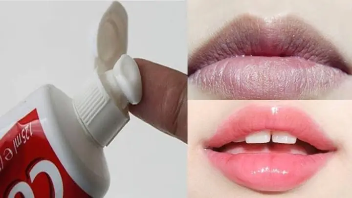 Kem Đánh Răng Có Trị Thâm Môi Không