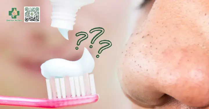 Kem Đánh Răng Trị Mụn Đầu Đen