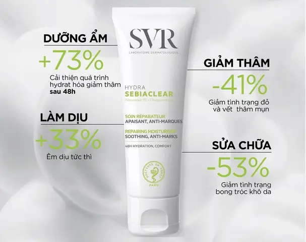 Kem Dưỡng Ẩm Cho Da Dầu Mụn Tốt Nhất
