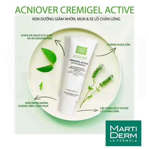 Kem Dưỡng Ẩm Không Chứa Dimethicone