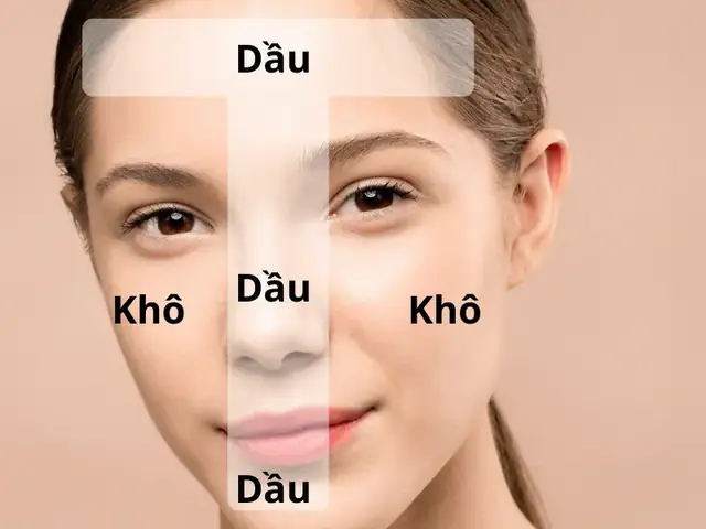 Kem Dưỡng Cho Da Hỗn Hợp Thiên Khô
