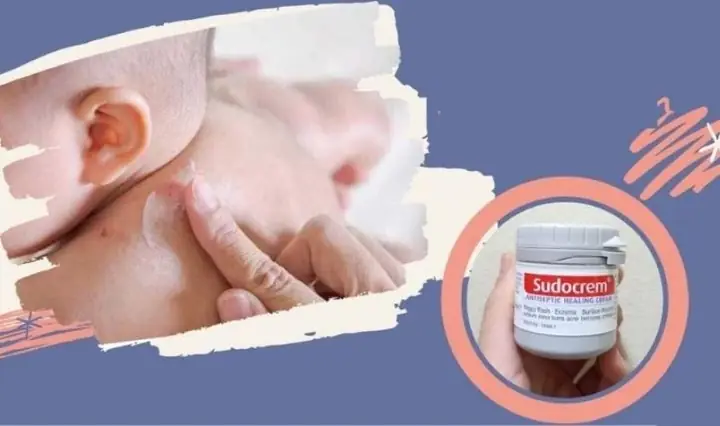 Kem Johnson Baby Có Tác Dụng Gì