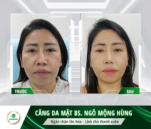 Kem Làm Căng Da Mặt Của Nhật