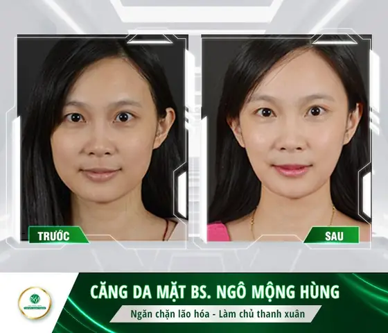 Kem Làm Căng Da Mặt Của Nhật