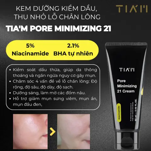 Kem Làm Nhỏ Lỗ Chân Lông