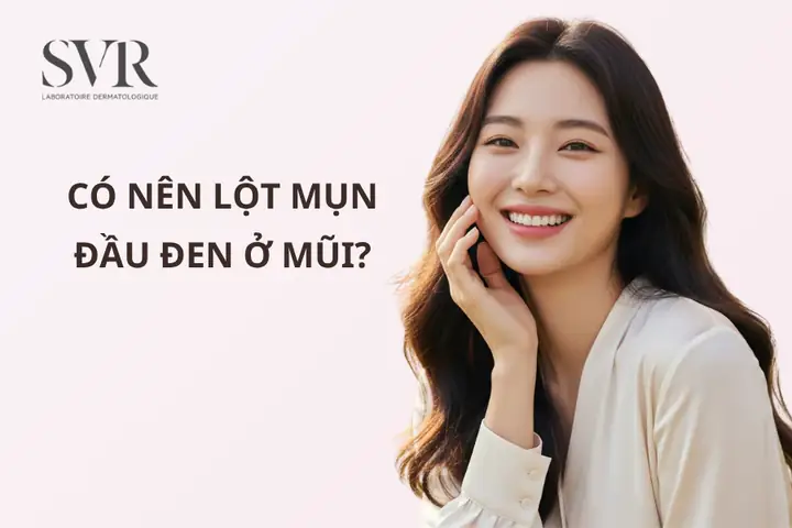 Kem Lột Mụn Đầu Đen Ở Mũi