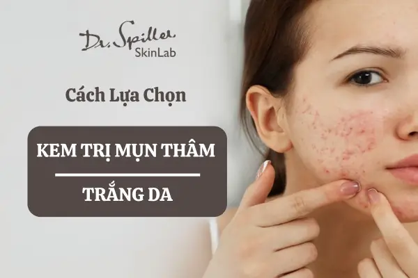 Kem Trang Da Tri Mun Tot Nhat