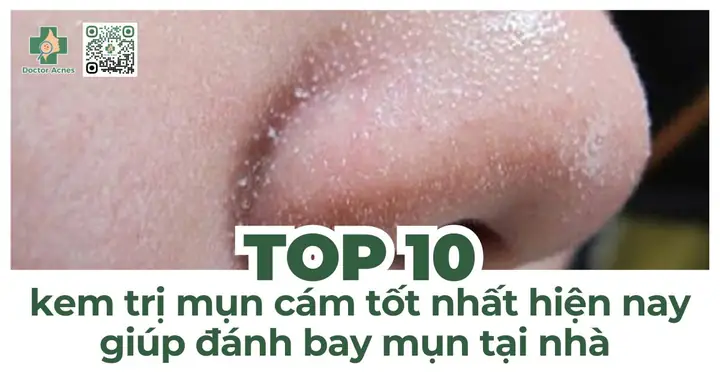 Kem Trị Mụn Cám Tốt Nhất