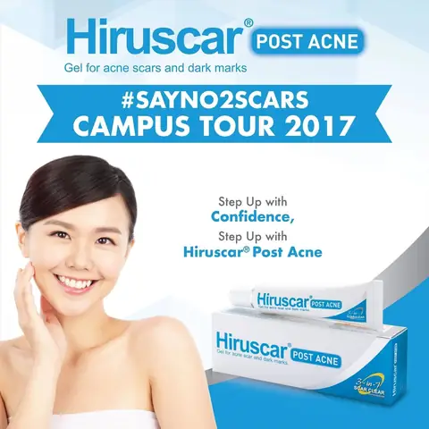 Kem Trị Mụn Tốt Nhất 2017