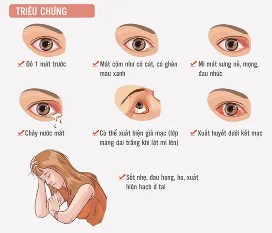Khám Bệnh Về Mắt Ở Đâu