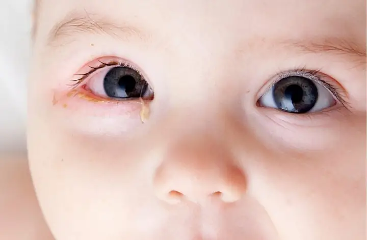 Khám Mắt Trẻ Sơ Sinh Ở Đâu