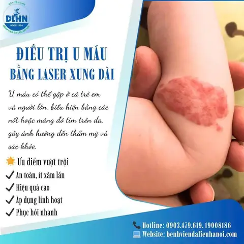 Khoa Da Liễu Bệnh Viện Xanh Pôn
