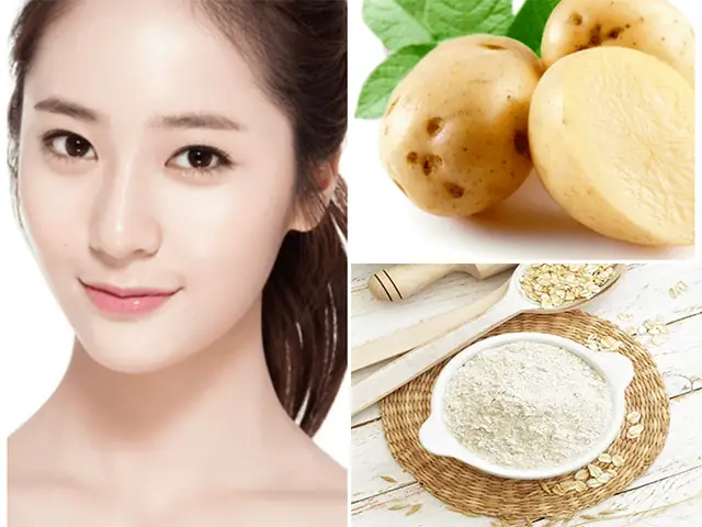 Khoai Tây Đắp Mặt Trị Mụn