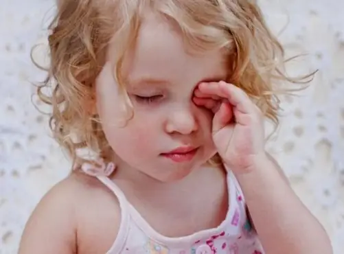 Làm Gì Khi Bé Bị Đau Mắt