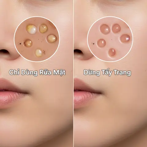 Làm Gì Khi Con Bú Môi