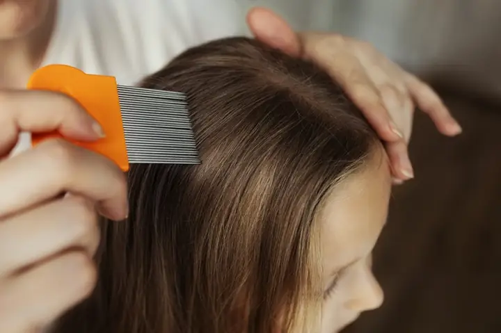 Làm Sao Để Hết Chấy Nhanh Nhất