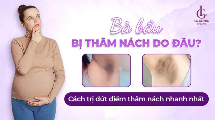 Làm Sao Để Trị Thâm Nách
