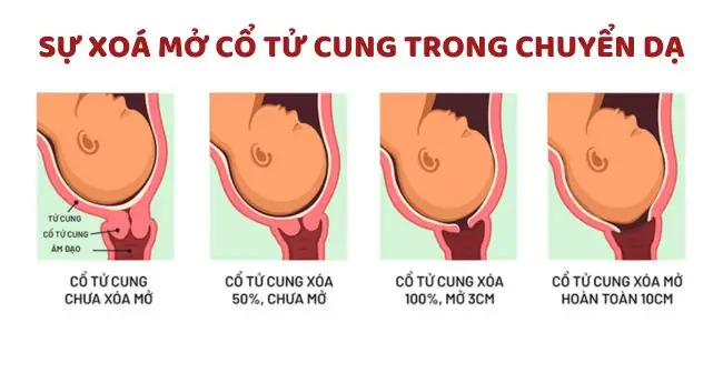 Làm Thế Nào Để Có Cơn Chuyển Dạ
