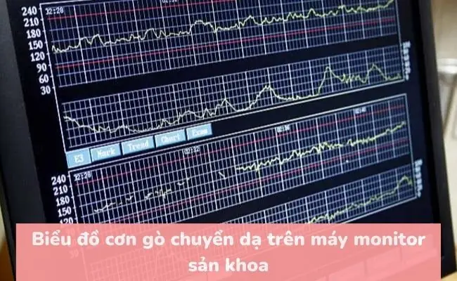 Làm Thế Nào Để Có Cơn Chuyển Dạ