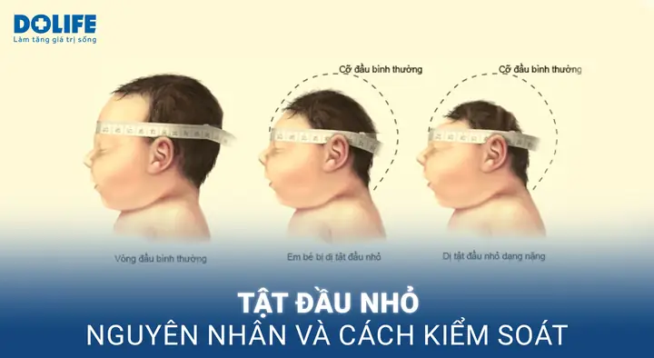 Làm Thế Nào Để Đầu Không Bị Bết