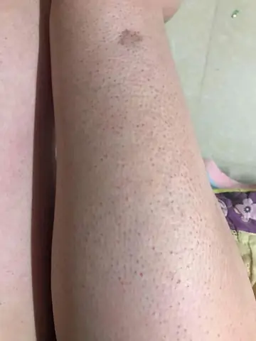 Làm Thế Nào Để Sạch Lông Chân