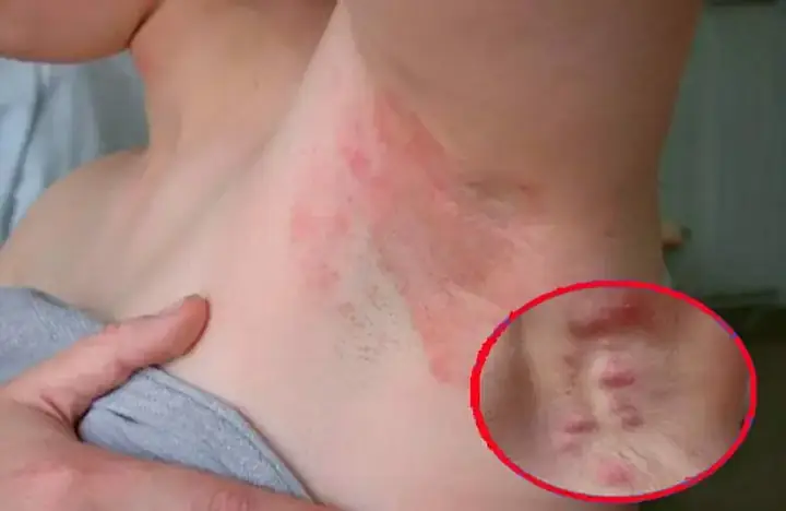 Làm Thế Nào Để Triệt Lông Nách