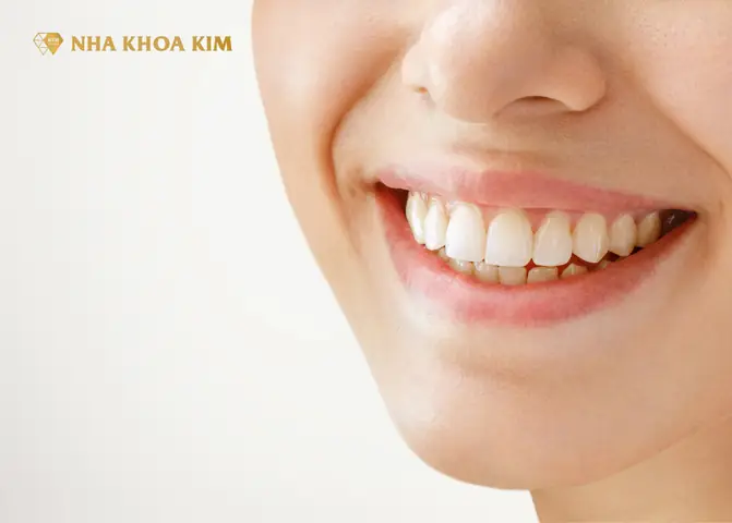 Làm Trắng Răng Cho Be 2 Tuổi