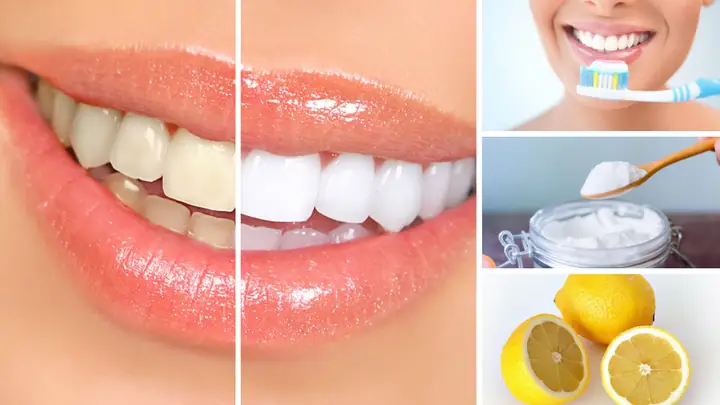 Làm Trắng Răng Cho Be 2 Tuổi