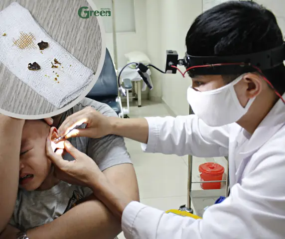 Lấy Ráy Tai Khô Cho Bé