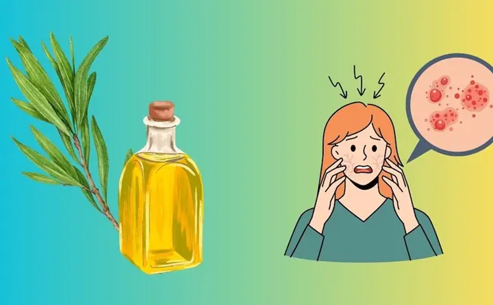 Lợi Ích Của Tinh Dầu Tràm