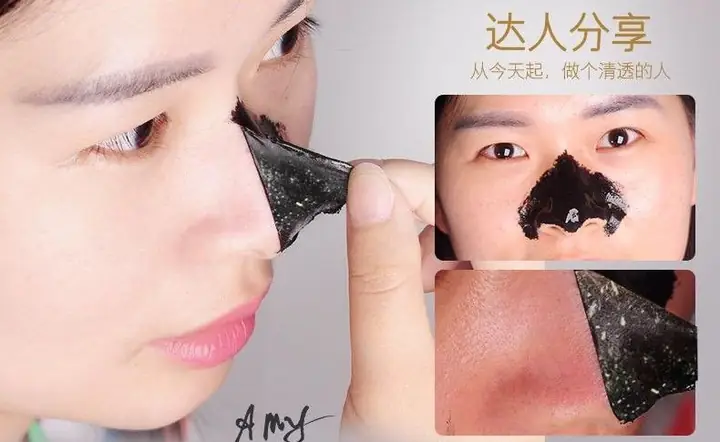 Lột Mụn Đầu Đen Ở Mũi Đúng Cách