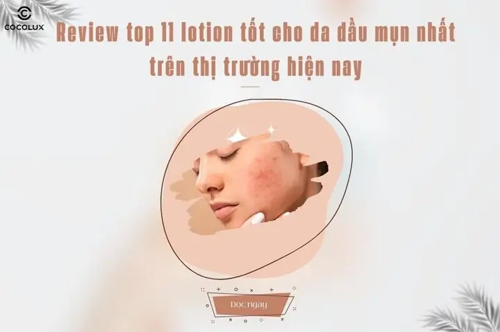Lotion Nhật Cho Da Dầu Mụn